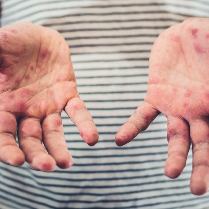 Infectious Disease Cleanup In Nebraska	Near Me Infectious Disease Cleanup In Nebraska	Near Me